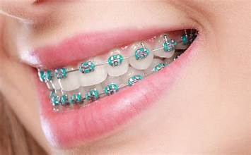 Orthodontist in Gardena, CA - Invisalign and traditional braces for all ages